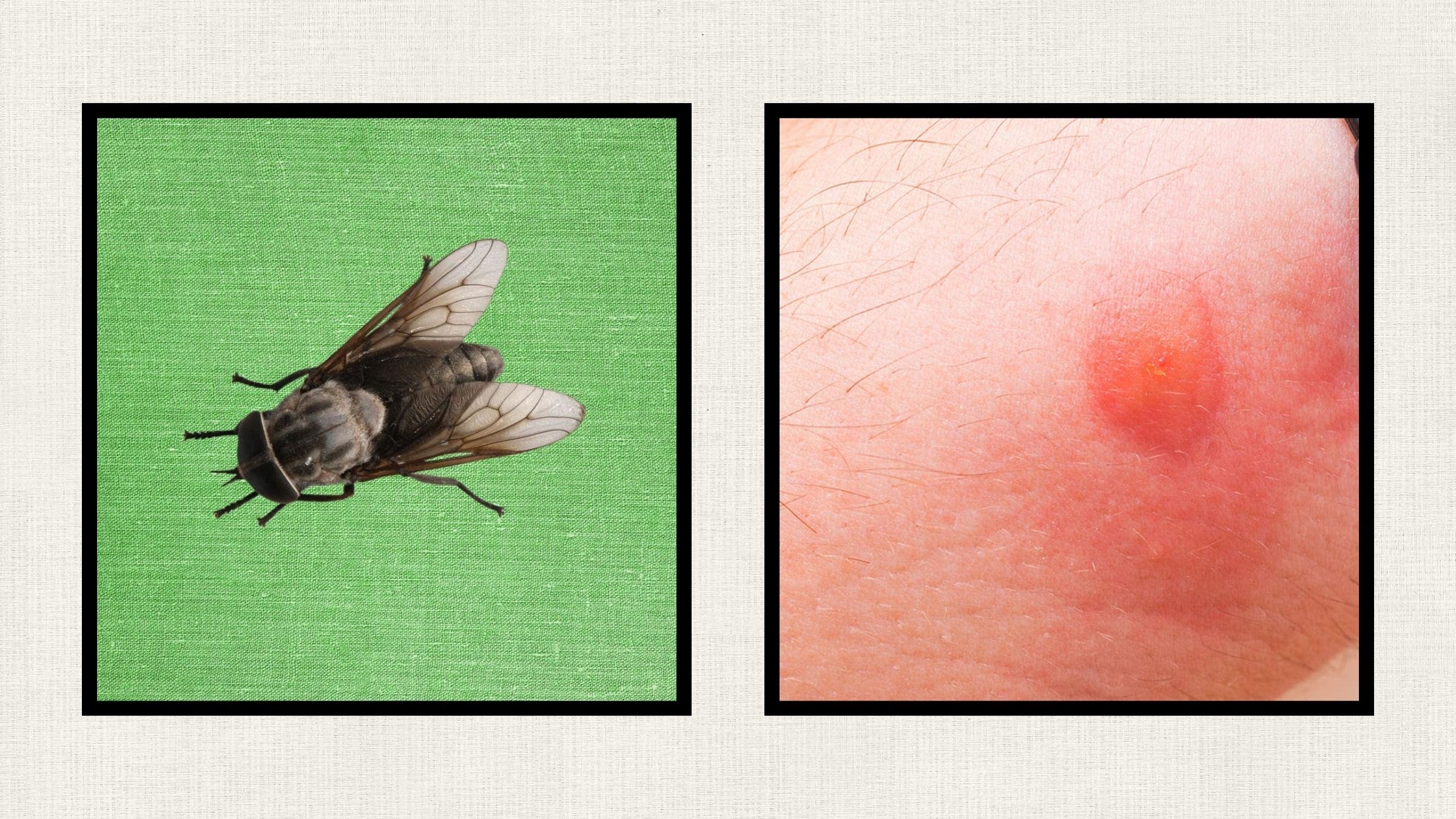 horsefly and a horsefly bite