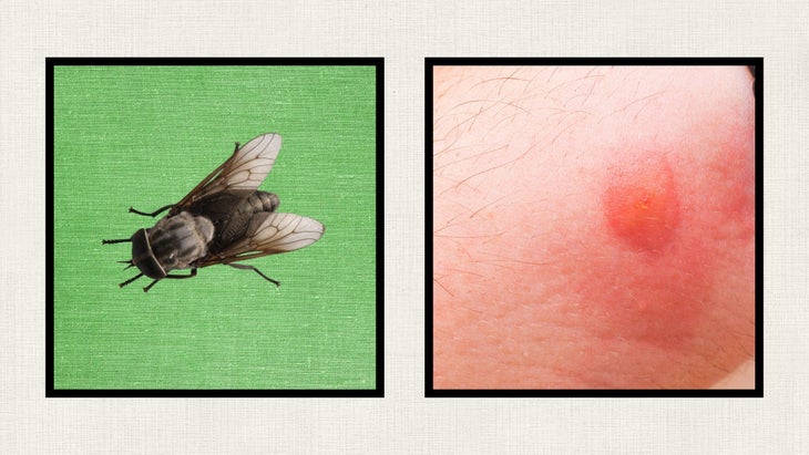 horsefly and a horsefly bite