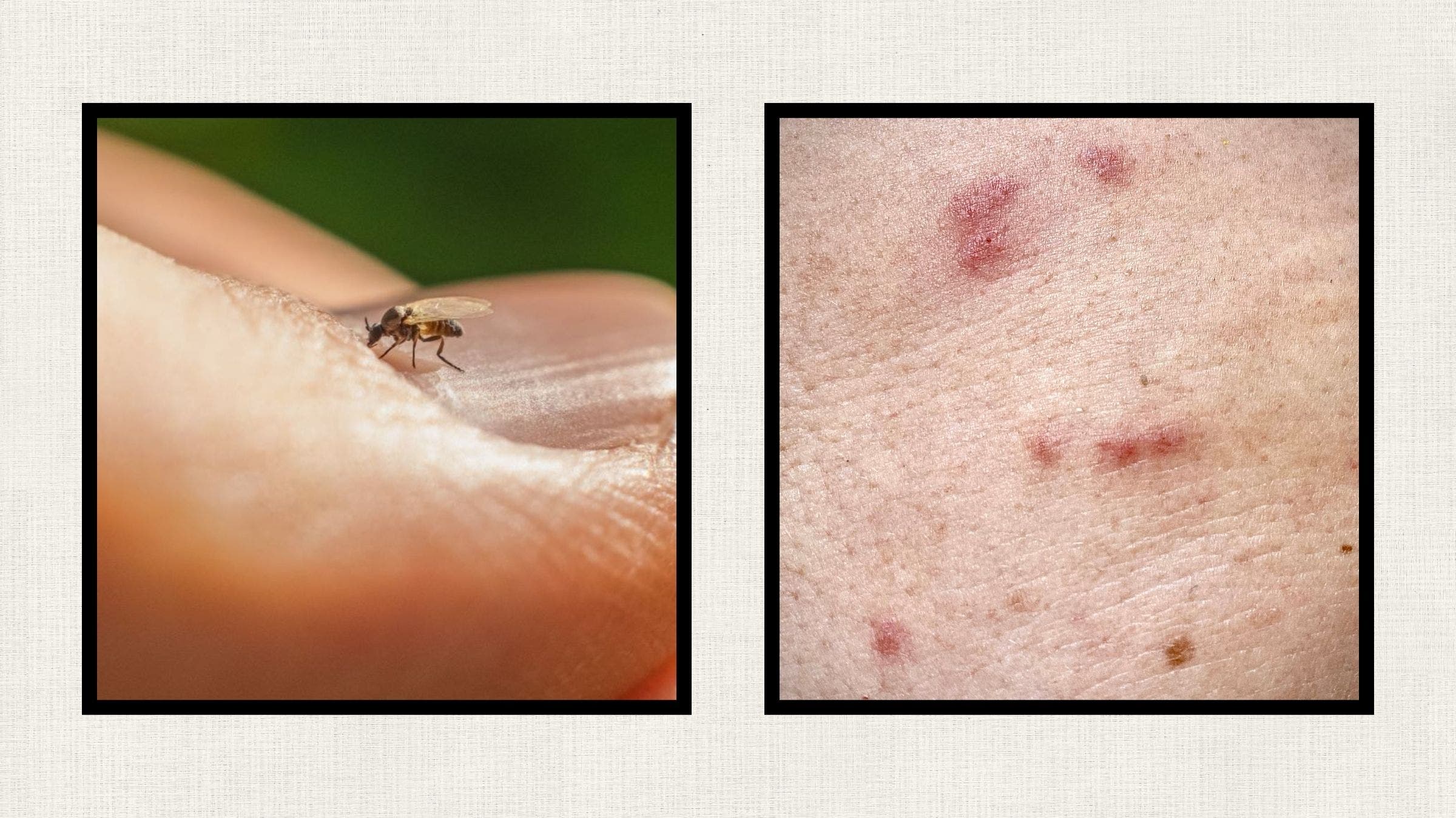 no see um, biting midge, and bites