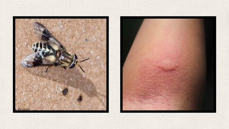 deer fly and deer fly bite