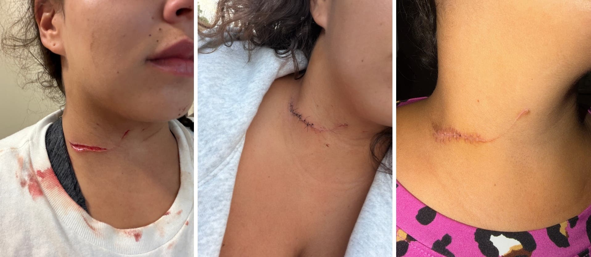 Images show Rowan's wound 