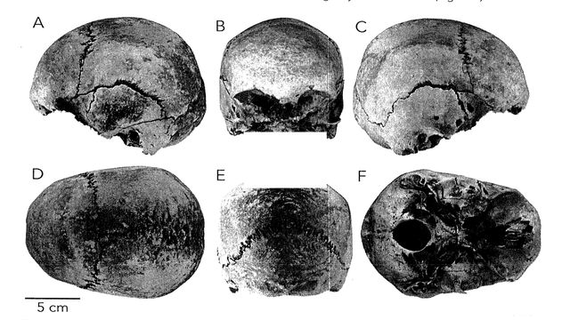 Kayakers Find Human Skull Near Popular Ohio National Park Service Picnic Area