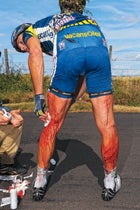 Johnny Hoogerland injury