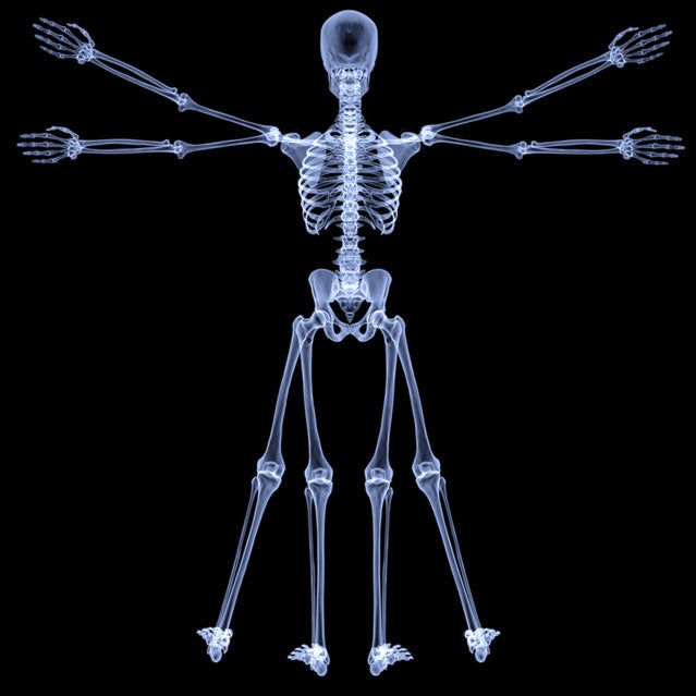 x-ray bones body cadaver Facebook readers feedback