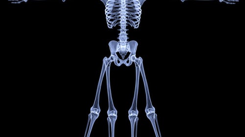 x-ray bones body cadaver Facebook readers feedback