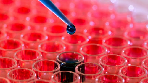 blood samples blood analysis athletic performance fitness