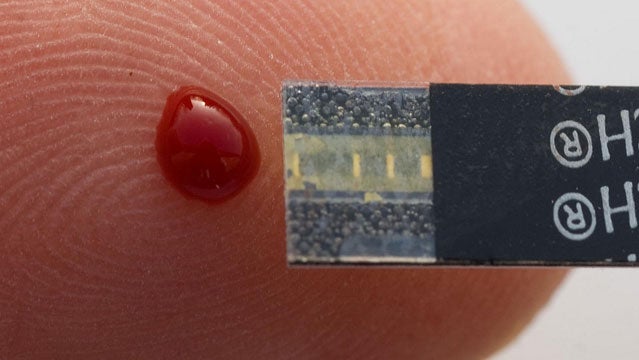 blood analysis test nutrition