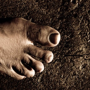 Plantar Fasciitis cure foot feet pain how to