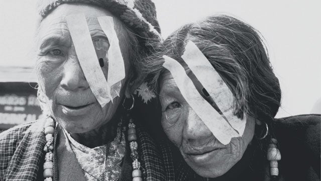 Patients at a Himalayan Cataract Project camp in Nepal