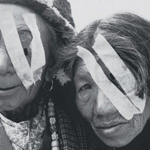 Patients at a Himalayan Cataract Project camp in Nepal