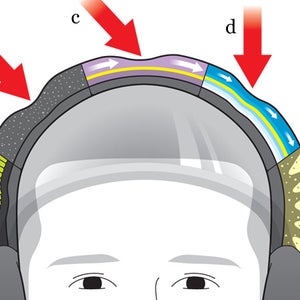 Brain Injury Outside Online TBI