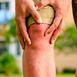 How should you treat an ACL injury?