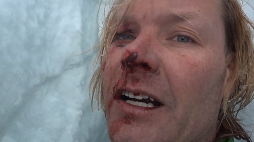 ԹϺOnline climber crevasse fall 70-foot broken bones ribs dislocated shoulder Mount Himlung Himalayal mountaineer climate scientist Dr doctor John All Nepal video footage recorded YouTube upload rescued rescue helicopter