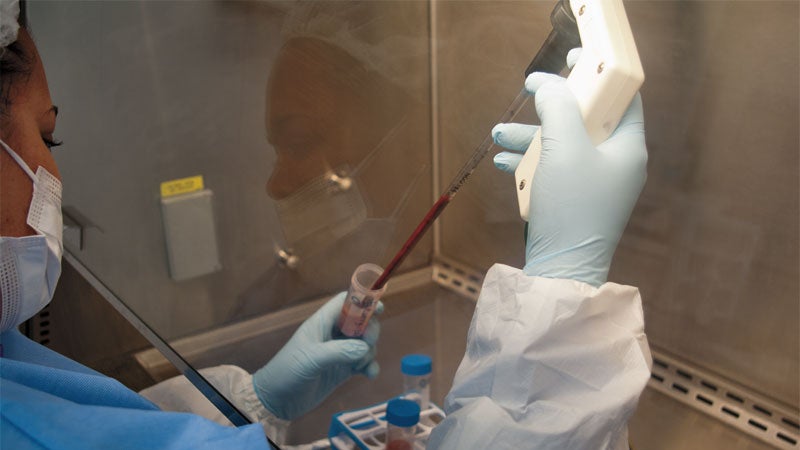 Bone marrow lab Regenexx Colora
